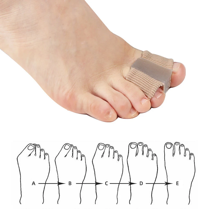 Nuovo Separatore per Dita del  - Toe Separator Silicon recensione e prezzo